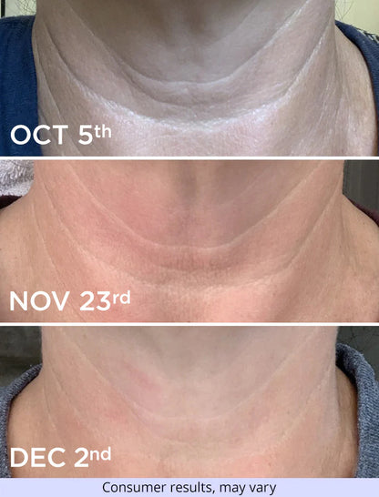 Neck Cream