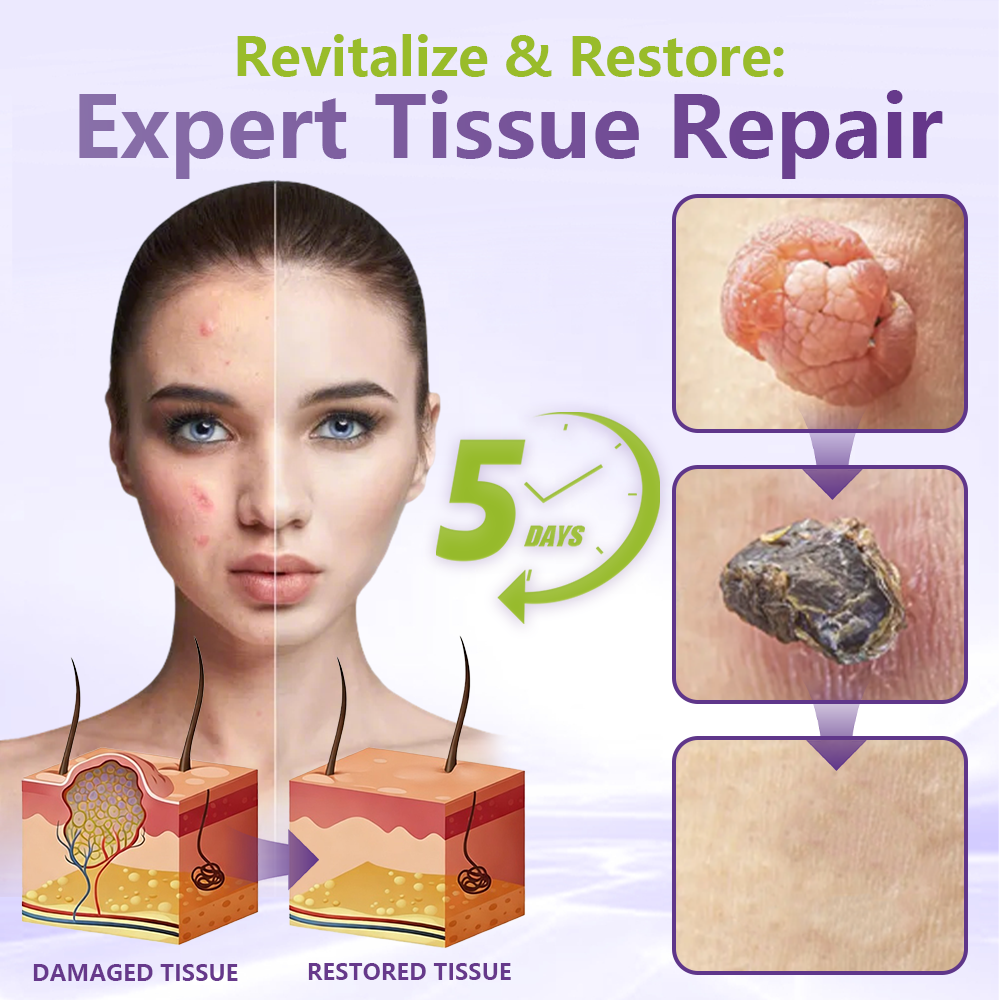 SOLUBLE MICRONEEDLE BOTANICAL SKIN TAG REMOVAL PATCH-$LA