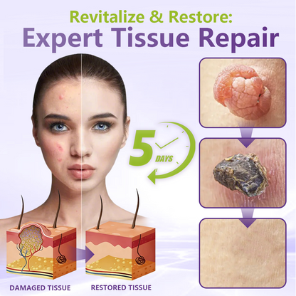SOLUBLE MICRONEEDLE BOTANICAL SKIN TAG REMOVAL PATCH-$LA