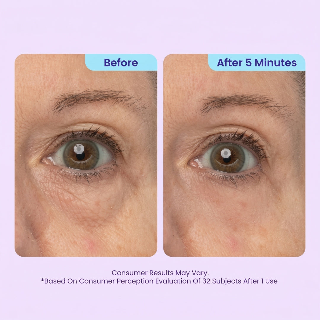 SPECIAL LAUNCH PRICE| Instant Lift Eye Gel -CJ