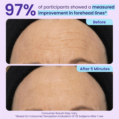 SPECIAL LAUNCH PRICE| Instant Lift Eye Gel -CJ