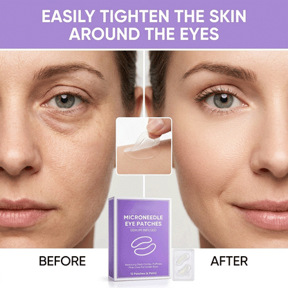WAKE UP LOOKING YEARS YOUNGER Hyaluronic Acid Microneedle Eye Mask-$LA