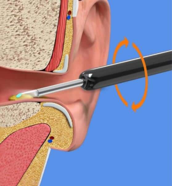 🎉LAST DAY 49% OFF👂Ear Cleaner with Camera