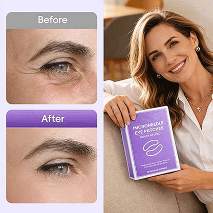 WAKE UP LOOKING YEARS YOUNGER Hyaluronic Acid Microneedle Eye Mask-$LA