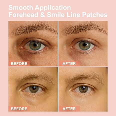 WAKE UP LOOKING YEARS YOUNGER Hyaluronic Acid Microneedle Eye Mask-$LA