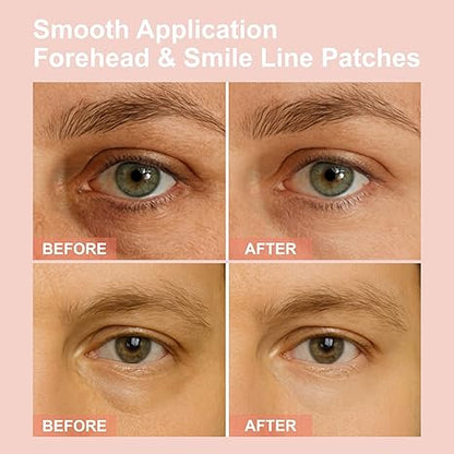 WAKE UP LOOKING YEARS YOUNGER Hyaluronic Acid Microneedle Eye Mask-$LA