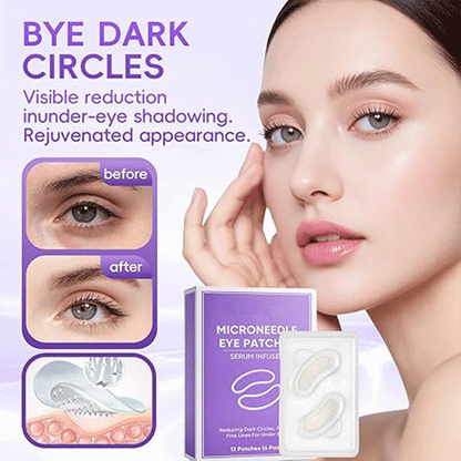 WAKE UP LOOKING YEARS YOUNGER Hyaluronic Acid Microneedle Eye Mask-$LA