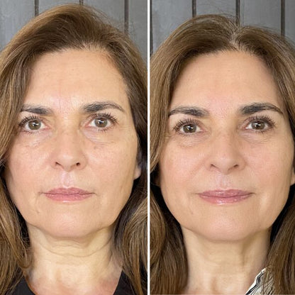 Gildedrust™ Red Light Eye Massager | Anti-Aging Eye Care Device for Dark Circles & Wrinkles -$AC