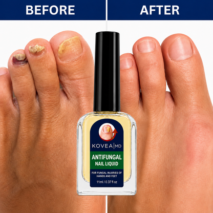💅✨Clear Fungus Nails & Restore Healthy Clear Nails in Just 14 Days! -$AC