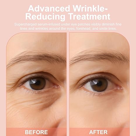 WAKE UP LOOKING YEARS YOUNGER Hyaluronic Acid Microneedle Eye Mask-$LA