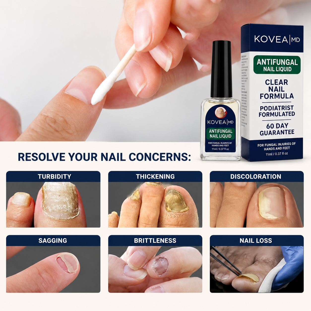 💅✨Clear Fungus Nails & Restore Healthy Clear Nails in Just 14 Days! -$AC