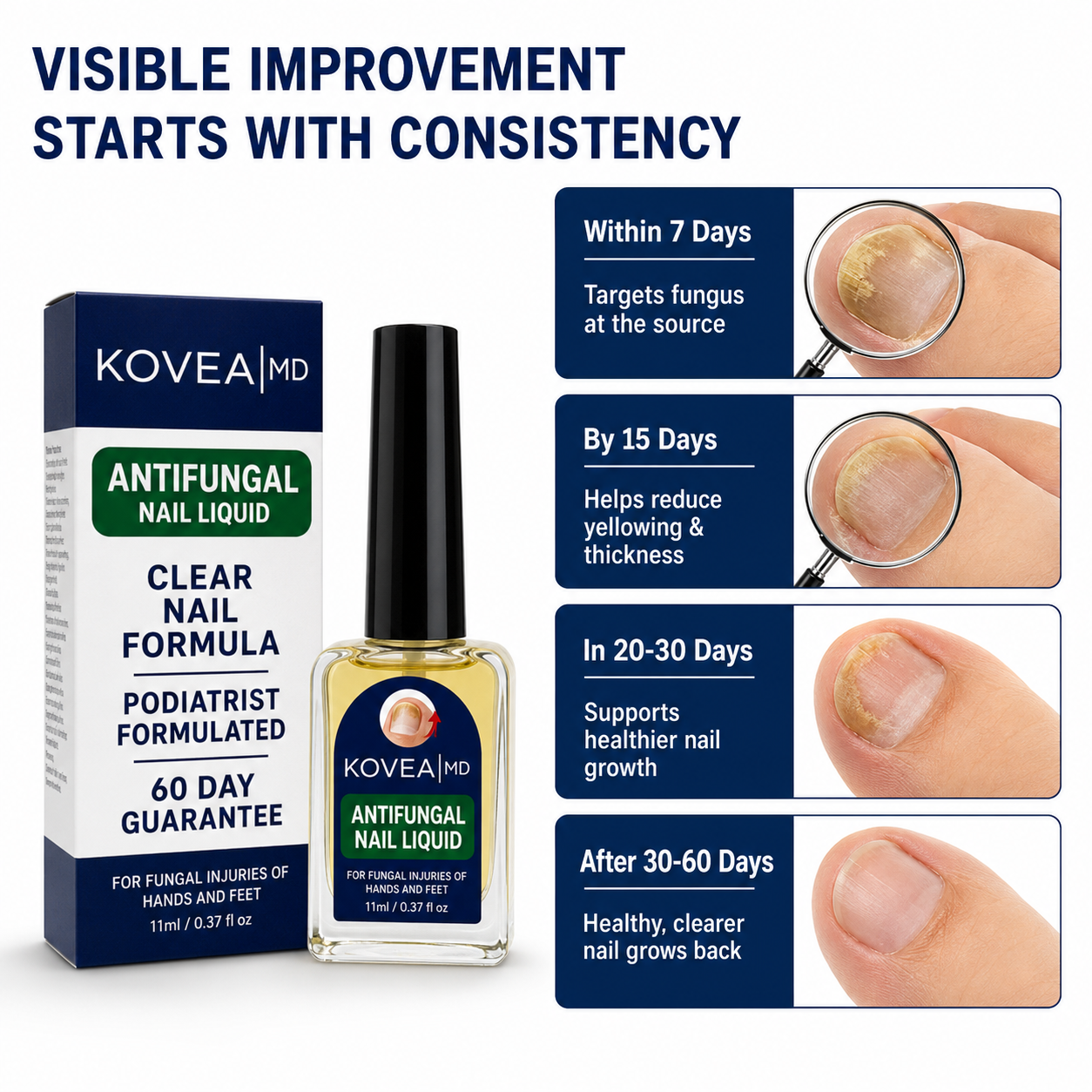 💅✨Clear Fungus Nails & Restore Healthy Clear Nails in Just 14 Days! -$AC