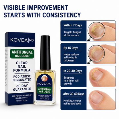 💅✨Clear Fungus Nails & Restore Healthy Clear Nails in Just 14 Days! -$AC