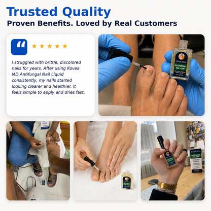💅✨Clear Fungus Nails & Restore Healthy Clear Nails in Just 14 Days! -$AC